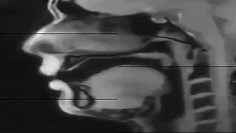 Live MRI video of movement of tongue while talking!