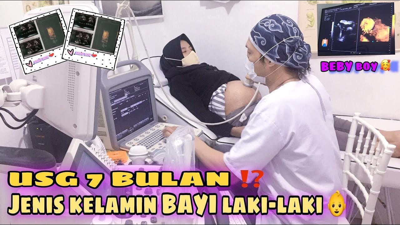 USG 4D JANIN 29 MINGGU || JENIS KELAMIN JANIN LAKI-LAKI