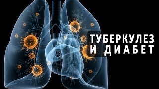 видео Диагностика туберкулеза — Необходимые анализы и методы диагностики