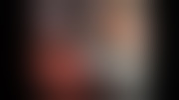 Uniportal（単孔式）胸腔鏡下肺葉切除術