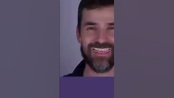 #exocad#medit#smile#design#shorts #short