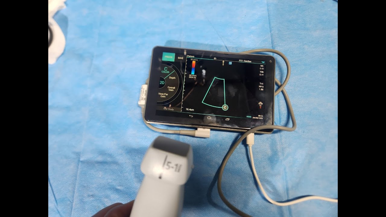 Sonosite iVIZ Ultrasound Machine - YouTube