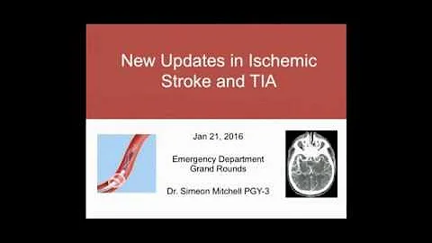 New Updates in Ischemic Stroke and TIA - DayDayNews