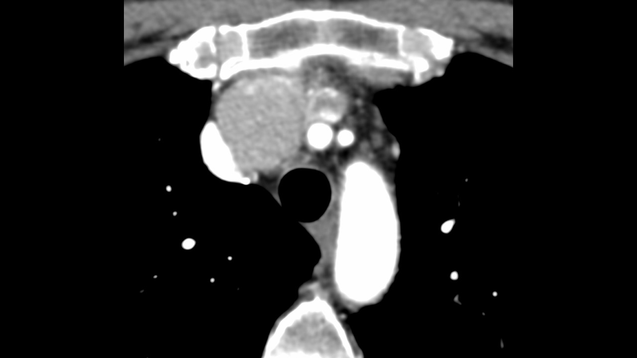 Вебинар по кардиоторакальной хирургии, 05.03.2026