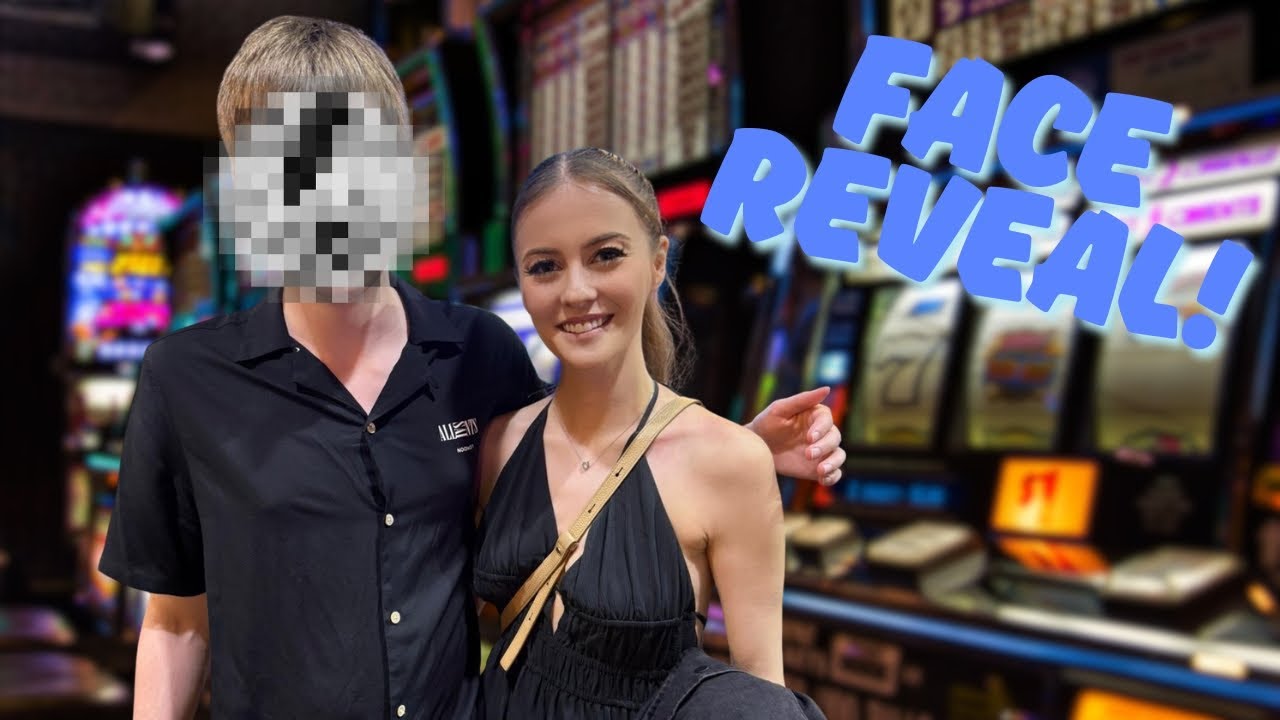 My Brother's Face Reveal (8 Years Later!)