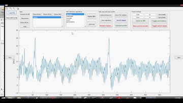 EKG Feature Extraction Tool