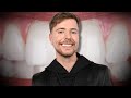 The Mystery Of MrBeast's Teeth