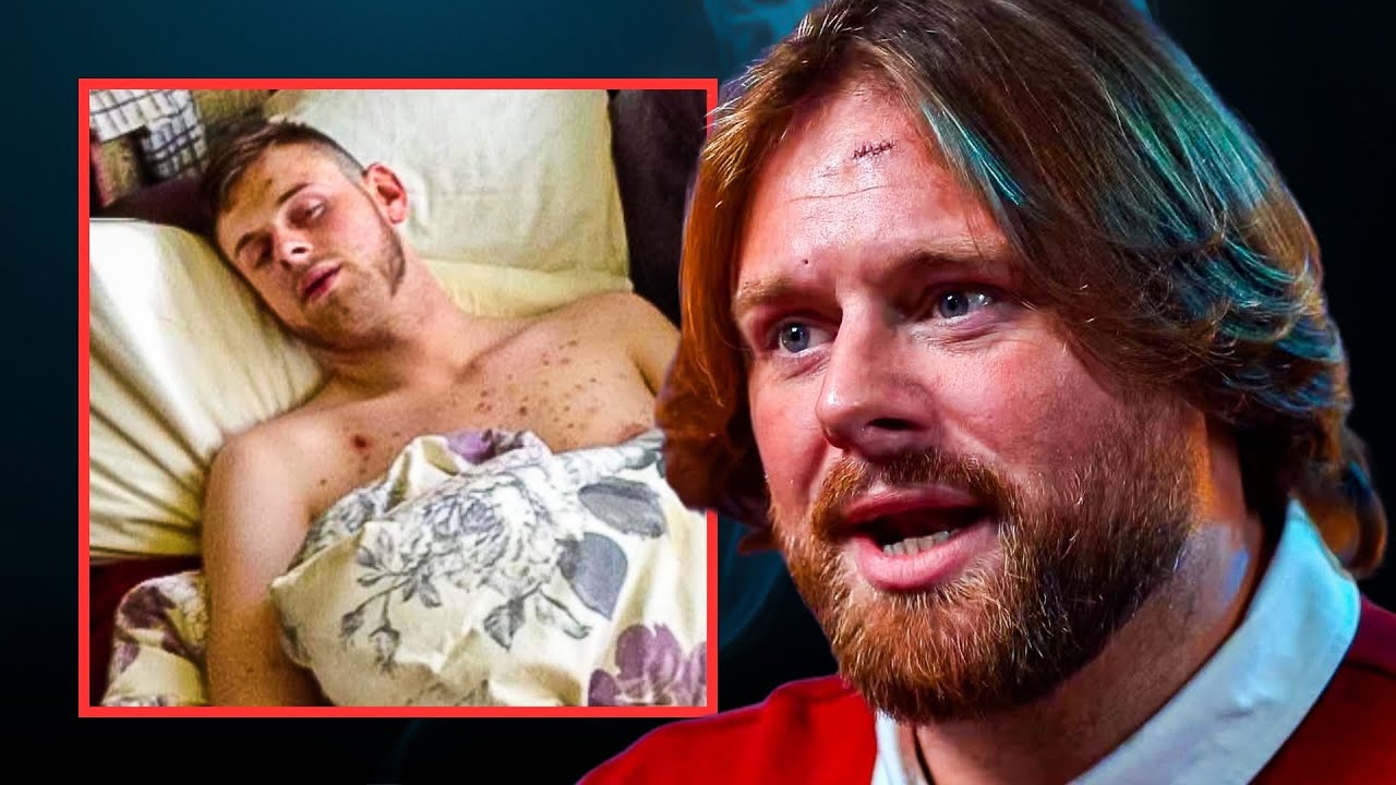 «Моя жизнь под героином» – бывший наркоман Каллейн Майс