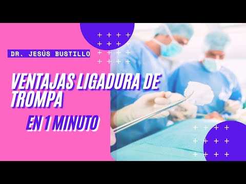 VENTAJAS de la