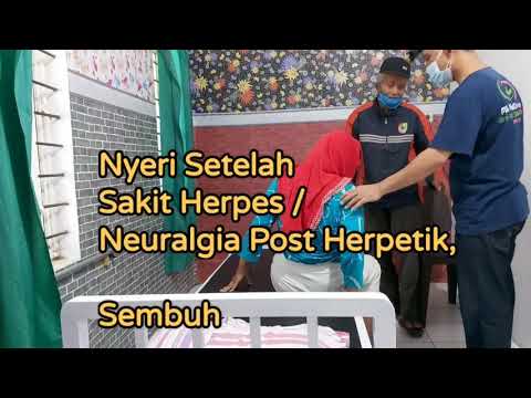 Ahli terapi nyeri gangguan saraf termasuk neuralgia post herpetik, nyeri karena penyakit Herpes bisa cepat sembuh di sini