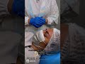 پاک کردن تاتو ابرو Remove Tattoo Eyebrows پاک کردن تاتو ابرو Remove Tattoo Eyebrows