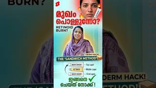 Retinoid പുരട്ടിയാൽ മുഖം പൊള്ളുന്നോ? ഇങ്ങനെ ചെയ്ത് നോക്ക്