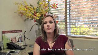 Keri San Diego Liposuction testimonial Dr Nowak