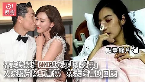 林志玲疑遭AKIRA家暴“打爆鼻”入院照片陆网疯传　高EQ回应｜01娱乐｜林志玲｜AKIRA - 天天要闻