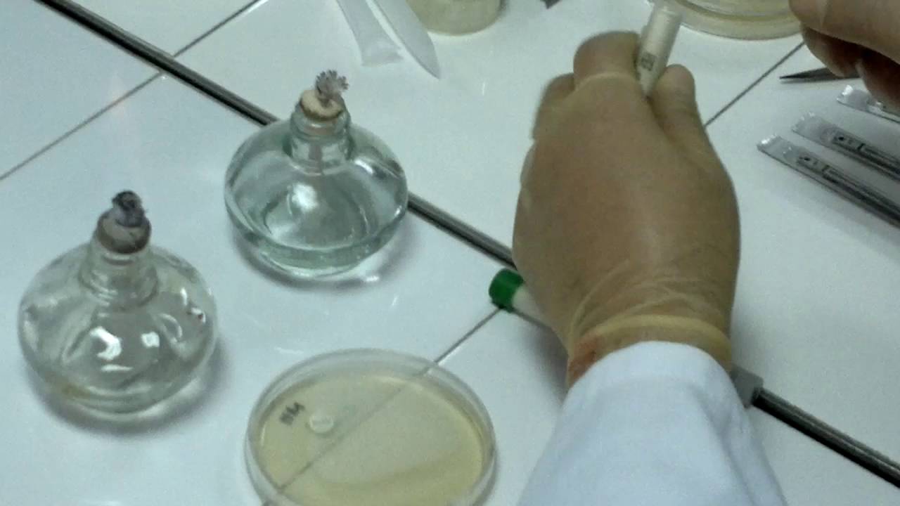 Antifungal Susceptibility Test YouTube