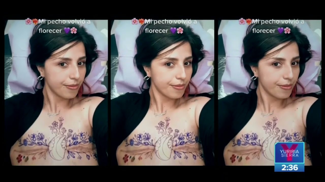 Sandra volvió a nacer tras el cáncer de mama y una mastectomía | Noticias con Yuriria Sierra