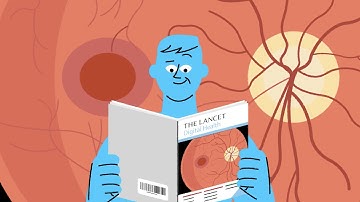 Dr. Noon CVD: Cardiovascular disease risk prediction through the simple eye scan