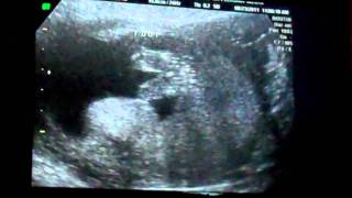 Jamie Julies Little One Its A...
