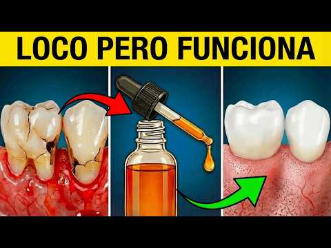 Olvídate del Enjuague Bucal — Este Aceite Elimina las Bacterias Dañinas de las Encías