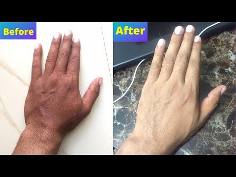 how to get your original skin color back - skin whitening home remedies