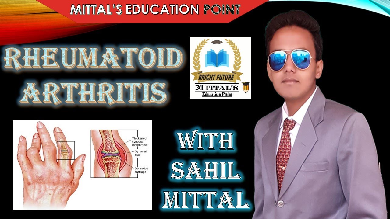 Rheumatoid Arthritis Definition Causes Symptoms Diagnosis
