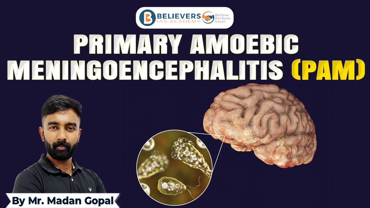 Pam Infection The Growing Threat of Primary Amoebic Meningoencephalitis (PAM ...