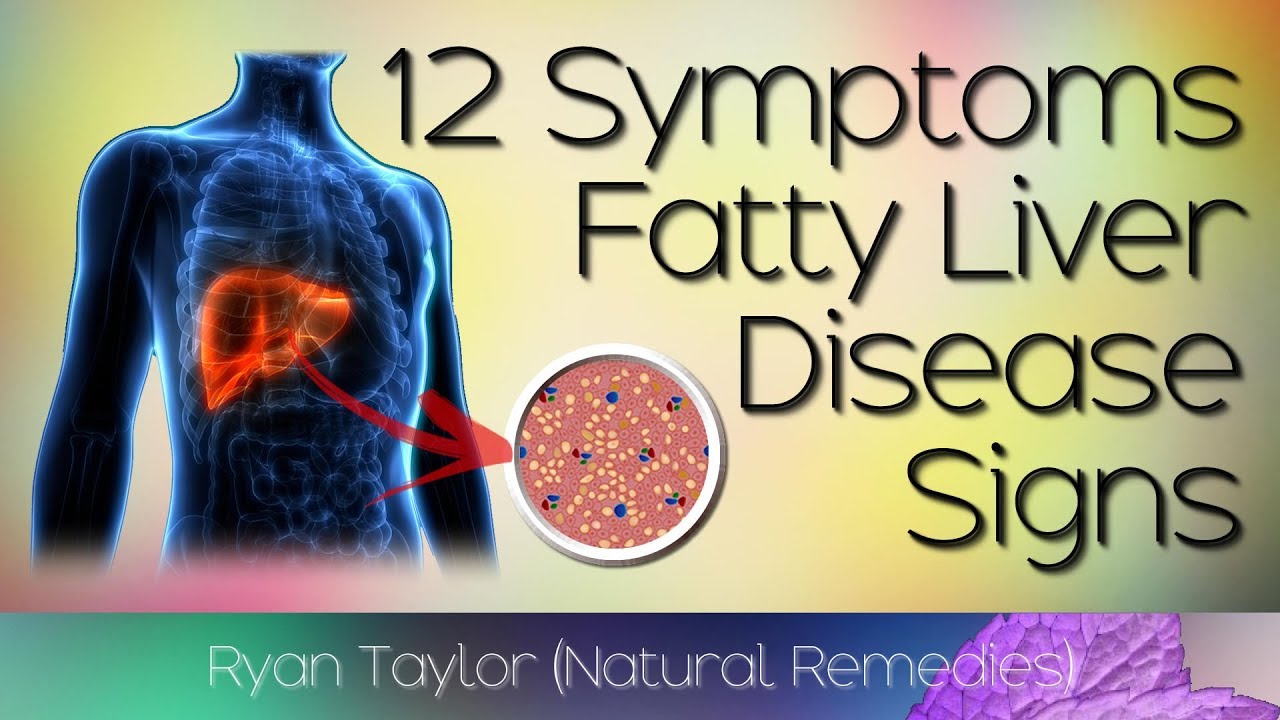 Signs Of Fatty Liver Disease Symptoms YouTube Signs of fatty liver disease symptoms youtube