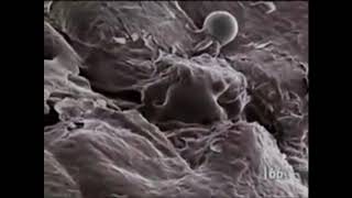 SHOCKED! Kulit Manusia Di Zoom Sampai 500 Ribu Kali