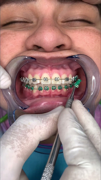 🔥Cita 📆 Mensual de ORTODONCIA🔥