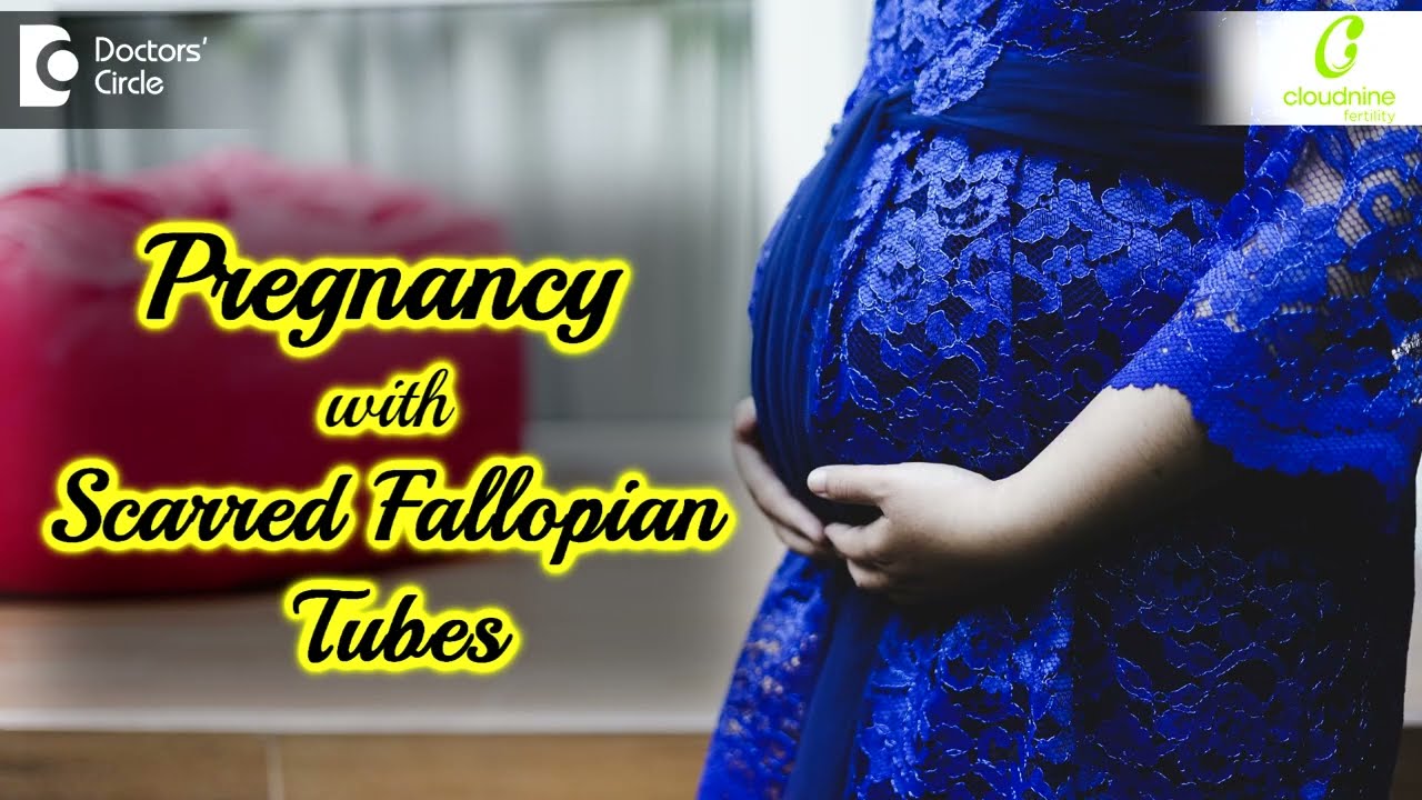 Getting PREGNANT with Scarred Fallopian Tubes I Dr. Sophia Devi I Cloudnine Hospital
