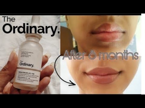 النياسيناميد و الألفا أربوتين للتصبغات و توحيد اللون المادة الفعالة الوحيدة لاسمرار حول الفم