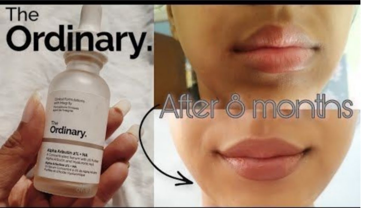 النياسيناميد و الألفا أربوتين للتصبغات و توحيد اللون/المادة الفعالة الوحيدة لاسمرار حول الفم