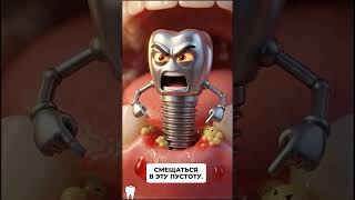 ЭТО Случится Если Вы НЕ Установите Зубной Имплант #имплантациязубов #зубныеимпланты #стоматология