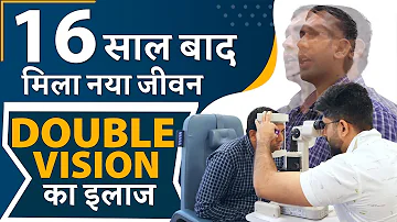 Double Vision का इलाज - IOL Explantation with the Placement of a Secondary IOL & Pupilloplasty