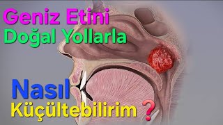 Geniz Etini Doğal Yollarla Nasıl Küçültebilirim?