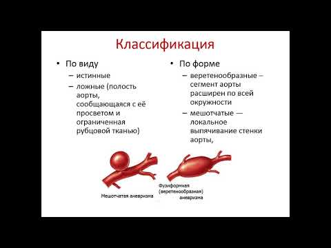 видеолекция аневризмы аорты