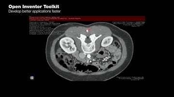 Open Inventor Toolkit | Measurement on Dicom dataset | 3D Visualization Toolkit