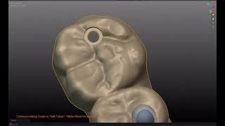 Exocad Installation &amp; Setup | Dental CAD/CAM Software - Remote Support Worldwide