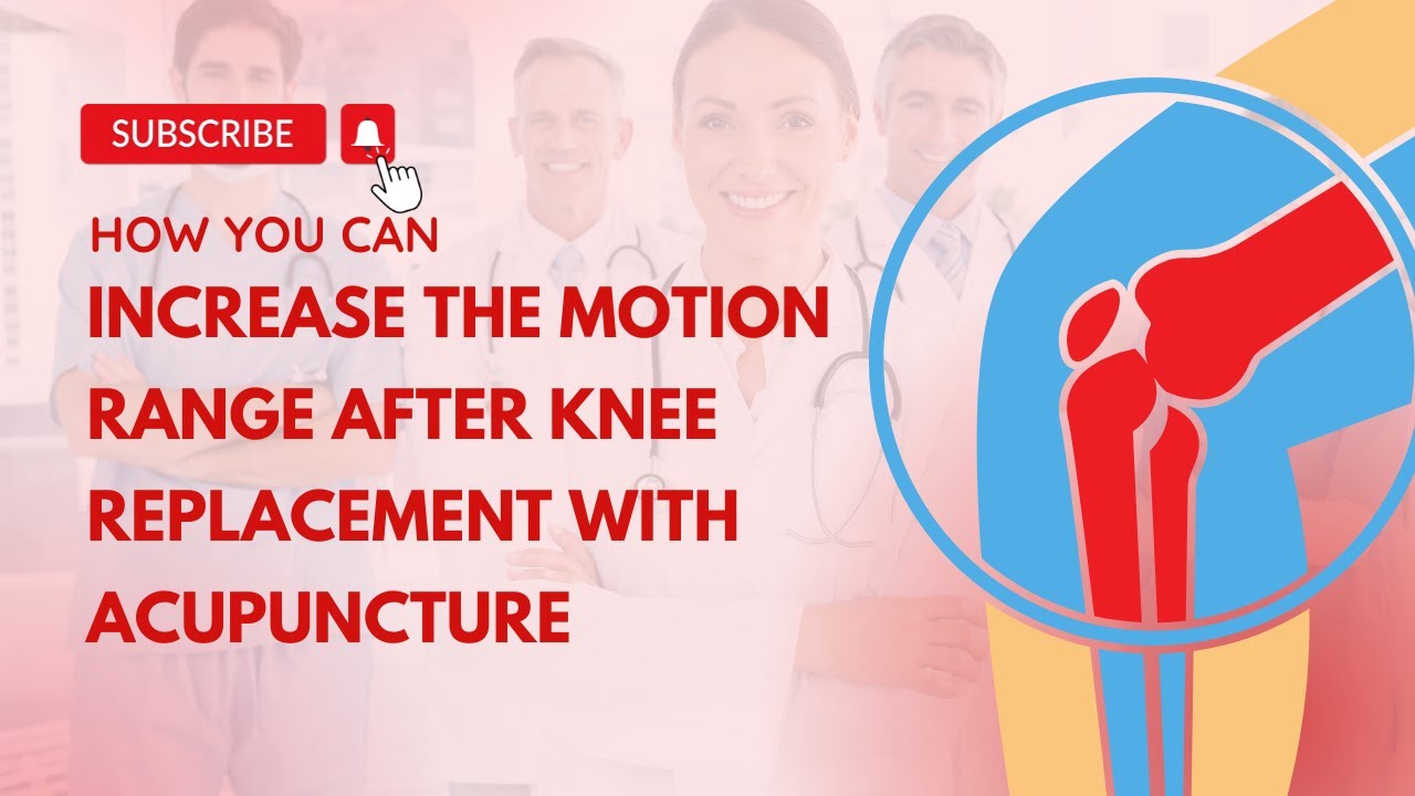 Increase the motion range after knee replacement with acupuncture YouTube