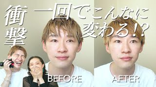 【マストバイ！！】話題のマッサージ機の小顔効果が凄すぎて正直ひいた