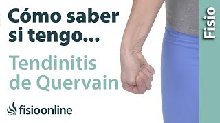 Cómo saber si tienes TENDINITIS de QUERVAIN o tendinitis del pulgar