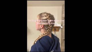 #braids #depression #fyp