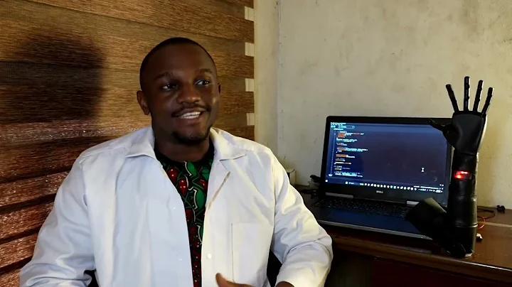 Nigerian firm develops breakthrough bionic arms for amputees | REUTERS