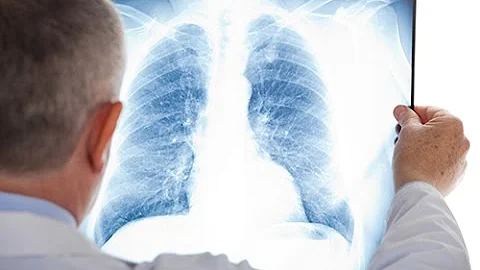 Quels sont les symptômes d'un embolie pulmonaire ?
