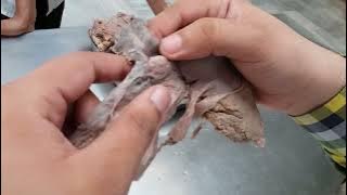 Uterus, Fallopian Tube & Ovary || Composite Viscera || Anatomy Episode 11