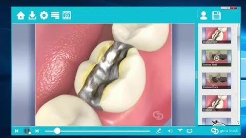 Guru Teach 6 -  Client Only (Workstation) Install