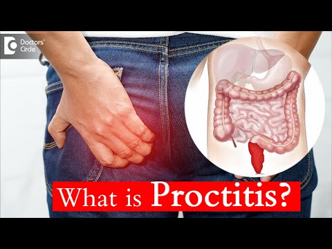 Proctitis: Causes, Treatment, and Surgery - Dr. Rajasekhar M R | Doctors&rsquo; Circle