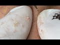 Satisfying Relaxing with Sac Dep Spa Video (#228)