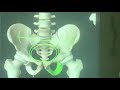 Terico n 10a osteologa del miembro inferior cintura plvica y muslo dr marcelo busquets
