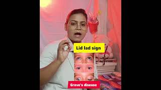 important sign series for norcet preparation #ytshorts #youtubeshorts #norcetpreparation #norcet2026